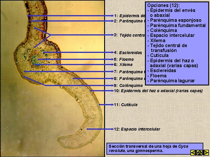 Opciones (12): - Epidermis del envés o abaxial 1: Epidermis del envés - Parénquima