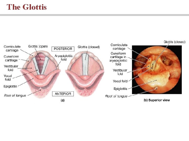 The Glottis 