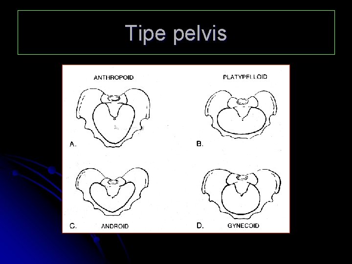 Tipe pelvis 