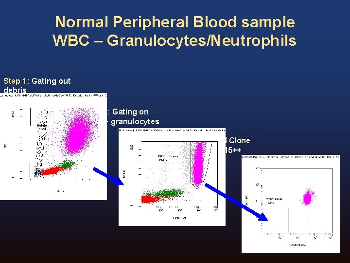 Normal Peripheral Blood sample WBC – Granulocytes/Neutrophils Step 1: Gating out debris Step 2: Normal Peripheral Blood sample WBC – Granulocytes/Neutrophils Step 1: Gating out debris Step 2: