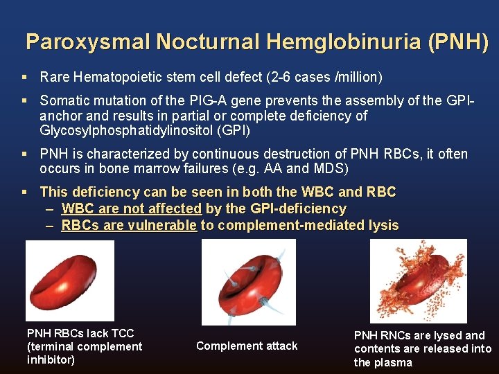 Paroxysmal Nocturnal Hemglobinuria (PNH) § Rare Hematopoietic stem cell defect (2 -6 cases /million) Paroxysmal Nocturnal Hemglobinuria (PNH) § Rare Hematopoietic stem cell defect (2 -6 cases /million)