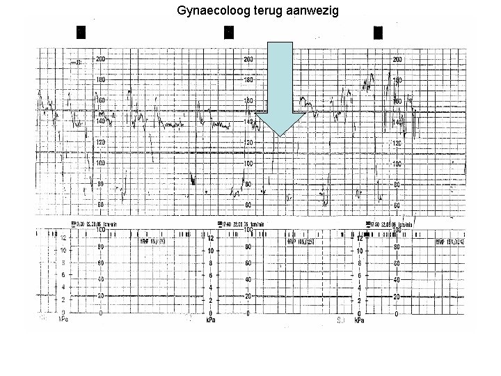 Gynaecoloog terug aanwezig 