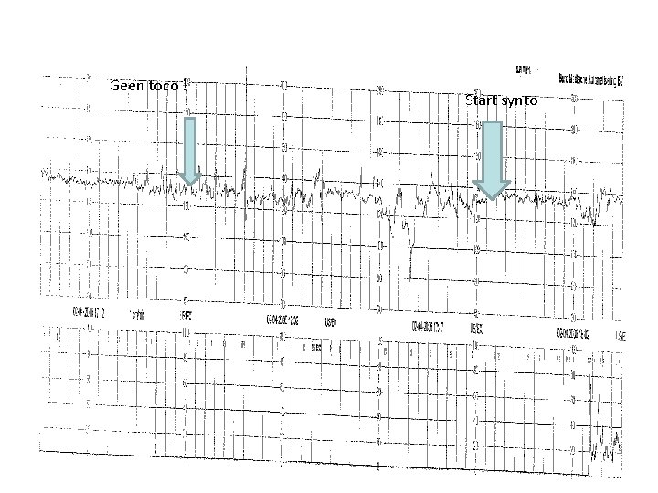 Geen toco ! Start synto 