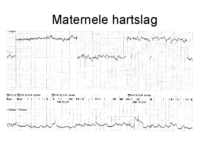 Maternele hartslag Maternele hartslag