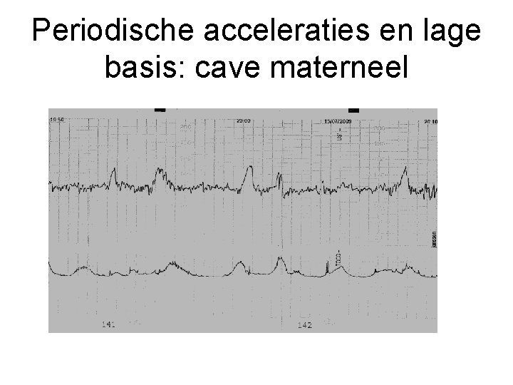 Periodische acceleraties en lage basis: cave materneel 