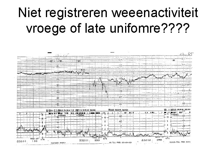 Niet registreren weeenactiviteit vroege of late unifomre? ? 