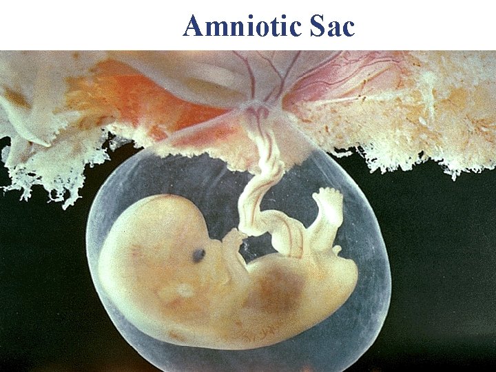 Amniotic Sac Amniotic Sac
