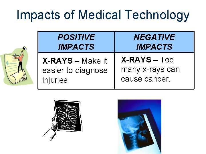 Impacts of Medical Technology POSITIVE IMPACTS X-RAYS – Make it easier to diagnose injuries