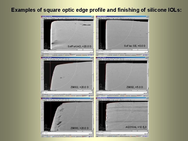 Examples of square optic edge profile and finishing of silicone IOLs: Sof. Port AO, Examples of square optic edge profile and finishing of silicone IOLs: Sof. Port AO,