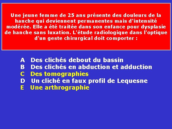 Une jeune femme de 25 ans présente des douleurs de la hanche qui deviennent