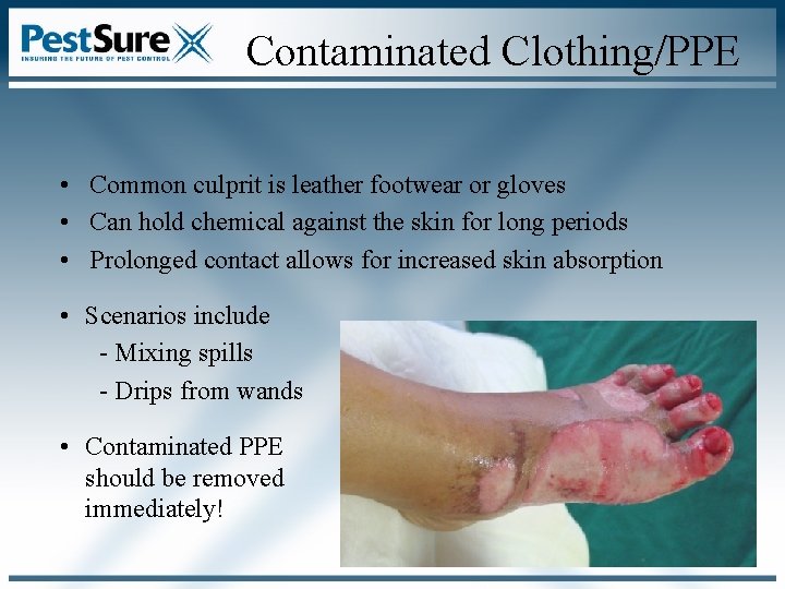 Contaminated Clothing/PPE • Common culprit is leather footwear or gloves • Can hold chemical Contaminated Clothing/PPE • Common culprit is leather footwear or gloves • Can hold chemical