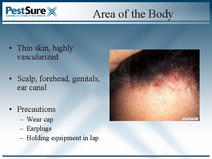 Area of the Body • Thin skin, highly vascularized • Scalp, forehead, genitals, ear Area of the Body • Thin skin, highly vascularized • Scalp, forehead, genitals, ear