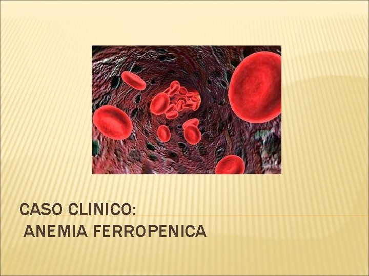 CASO CLINICO: ANEMIA FERROPENICA 