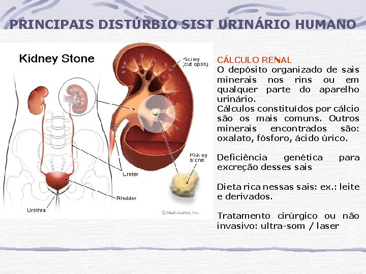 PRINCIPAIS DISTÚRBIO SIST URINÁRIO HUMANO CÁLCULO RENAL O depósito organizado de sais minerais nos PRINCIPAIS DISTÚRBIO SIST URINÁRIO HUMANO CÁLCULO RENAL O depósito organizado de sais minerais nos