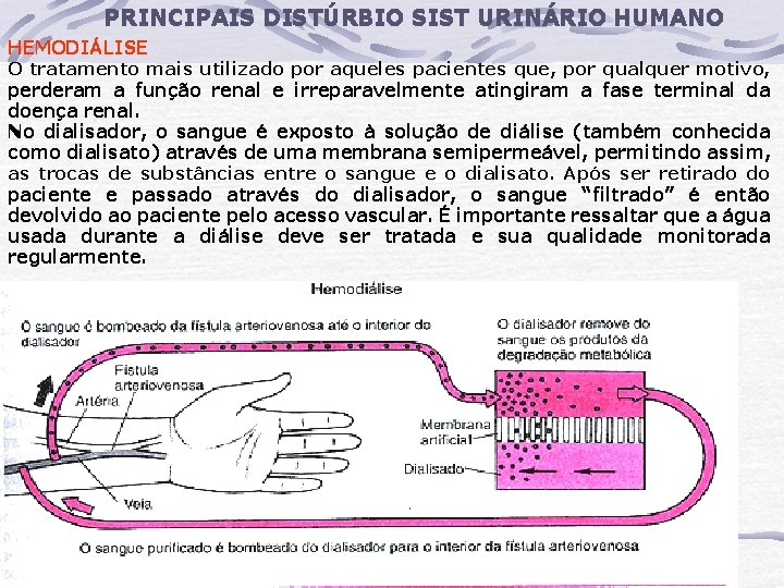 PRINCIPAIS DISTÚRBIO SIST URINÁRIO HUMANO HEMODIÁLISE O tratamento mais utilizado por aqueles pacientes que, PRINCIPAIS DISTÚRBIO SIST URINÁRIO HUMANO HEMODIÁLISE O tratamento mais utilizado por aqueles pacientes que,