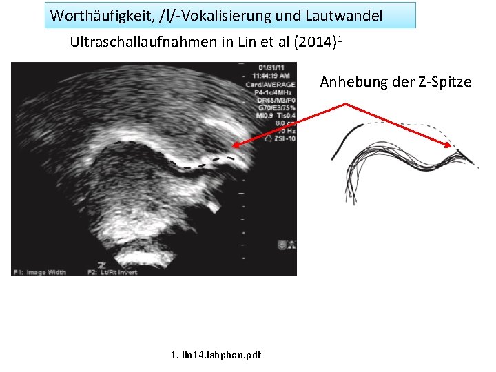 Worthäufigkeit, /l/-Vokalisierung und Lautwandel Ultraschallaufnahmen in Lin et al (2014)1 Anhebung der Z-Spitze 1.