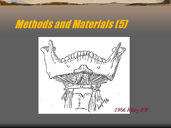 Methods and Materials (5) 1986 Riley RW 