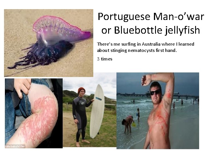 Portuguese Man-o’war or Bluebottle jellyfish There’s me surfing in Australia where I learned about