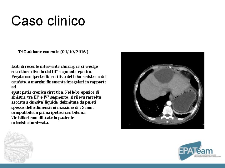 Caso clinico TAC addome con mdc (04/10/2016 ) Esiti di recente intervento chirurgico di Caso clinico TAC addome con mdc (04/10/2016 ) Esiti di recente intervento chirurgico di