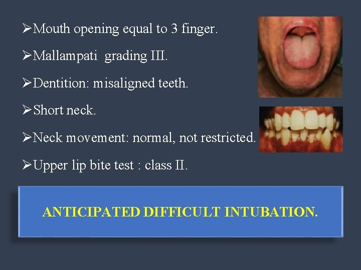 ØMouth opening equal to 3 finger. ØMallampati grading III. ØDentition: misaligned teeth. ØShort neck.