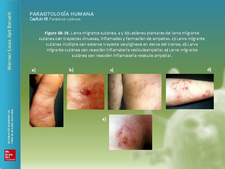 Werner Louis Apt Baruch Todos los derechos reservados. Mc. Graw-Hill Education LLC PARASITOLOGÍA HUMANA