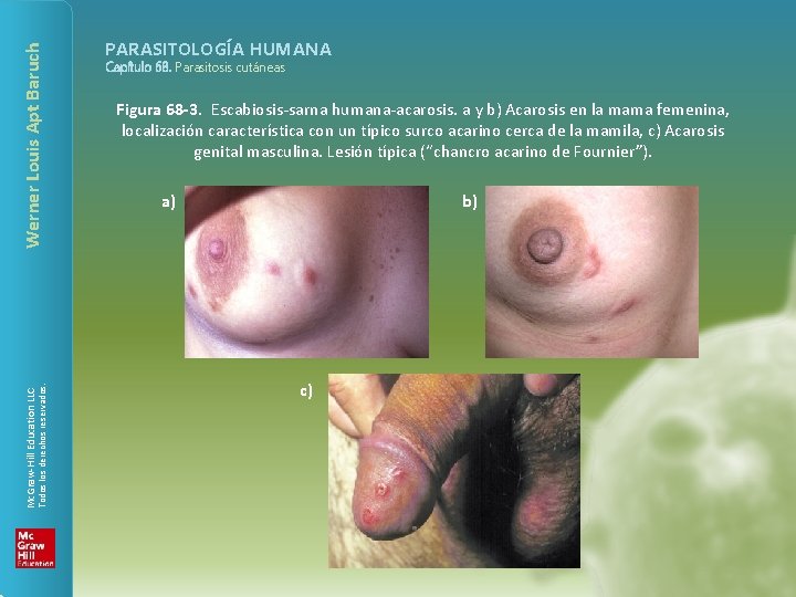 Werner Louis Apt Baruch Todos los derechos reservados. Mc. Graw-Hill Education LLC PARASITOLOGÍA HUMANA