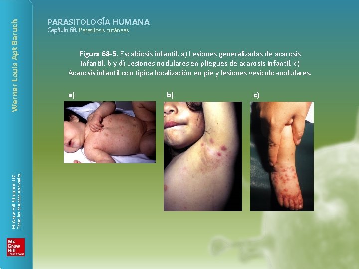 Werner Louis Apt Baruch Todos los derechos reservados. Mc. Graw-Hill Education LLC PARASITOLOGÍA HUMANA