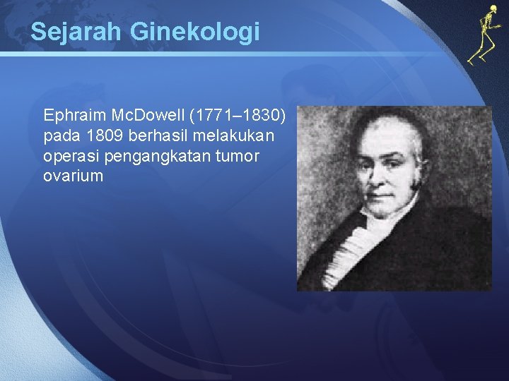 Sejarah Ginekologi Ephraim Mc. Dowell (1771– 1830) pada 1809 berhasil melakukan operasi pengangkatan tumor