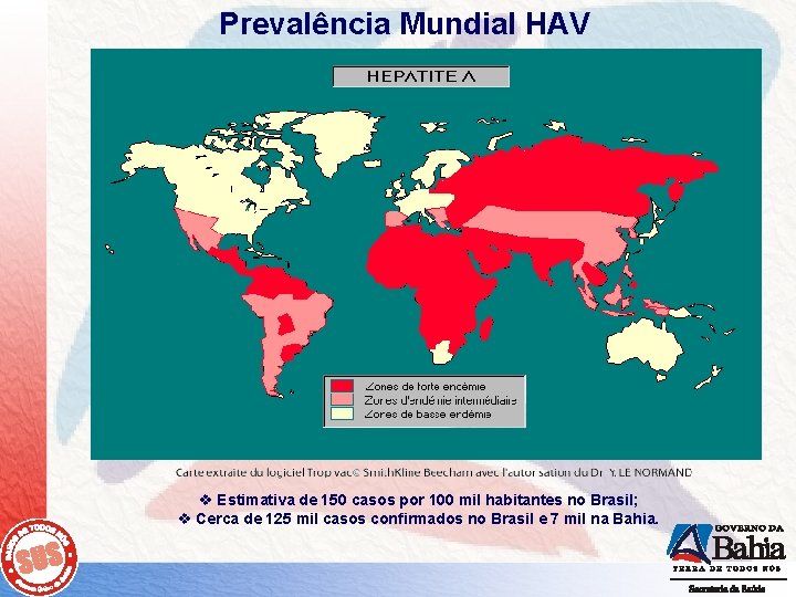 Prevalência Mundial HAV v Estimativa de 150 casos por 100 mil habitantes no Brasil;