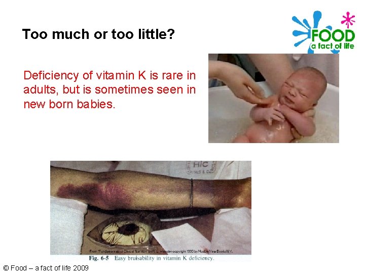 Too much or too little? Deficiency of vitamin K is rare in adults, but