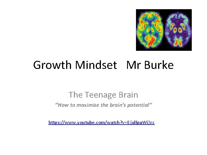 Growth Mindset Mr Burke The Teenage Brain ‘’How to maximise the brain’s potential’’ https: