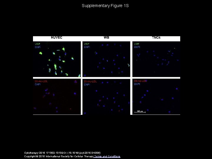 Supplementary Figure 1 S Cytotherapy 2015 171302 -1313 DOI: (10. 1016/j. jcyt. 2015. 04.