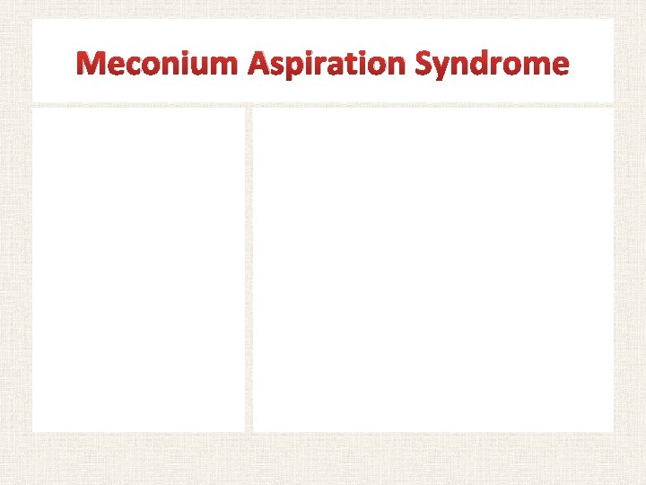 Meconium Aspiration Syndrome Chest radiograph of an infant with MAS Notice the bilateral patchy