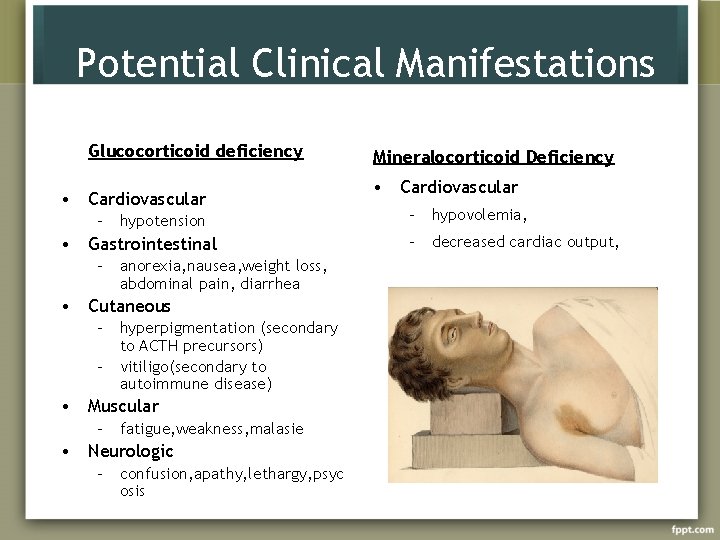 Potential Clinical Manifestations Glucocorticoid deficiency • Cardiovascular – hypotension • Gastrointestinal – anorexia, nausea,