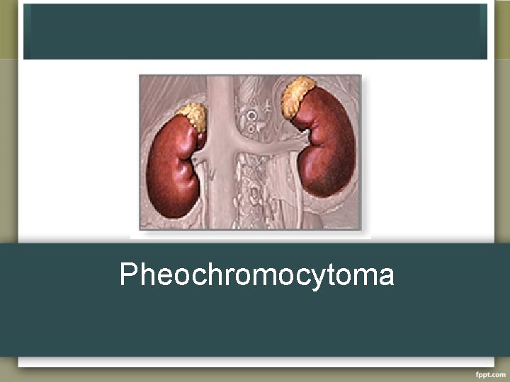 Pheochromocytoma 