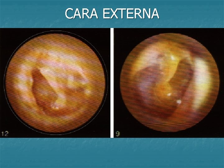 CARA EXTERNA 