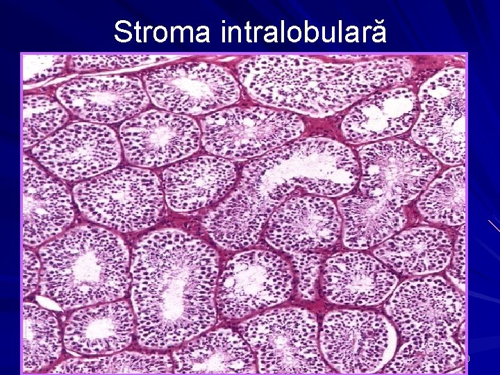 Stroma intralobulară 10 