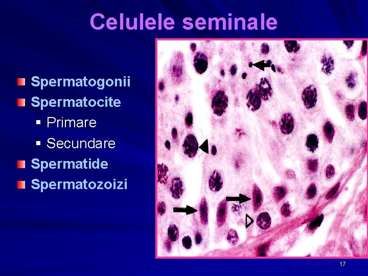 Celulele seminale Spermatogonii Spermatocite § Primare § Secundare Spermatide Spermatozoizi 17 