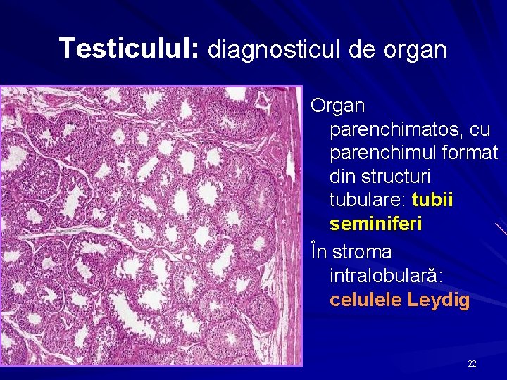 Testiculul: diagnosticul de organ Organ parenchimatos, cu parenchimul format din structuri tubulare: tubii seminiferi