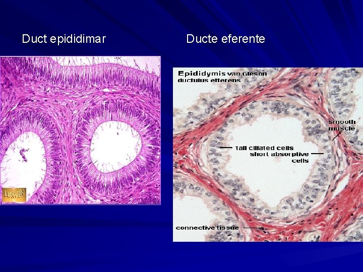 Duct epididimar Ducte eferente 