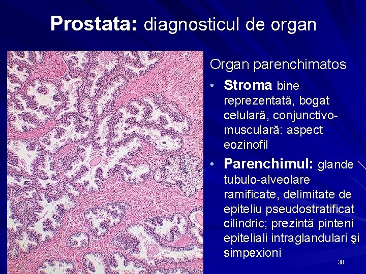 Prostata: diagnosticul de organ Organ parenchimatos • Stroma bine reprezentată, bogat celulară, conjunctivomusculară: aspect