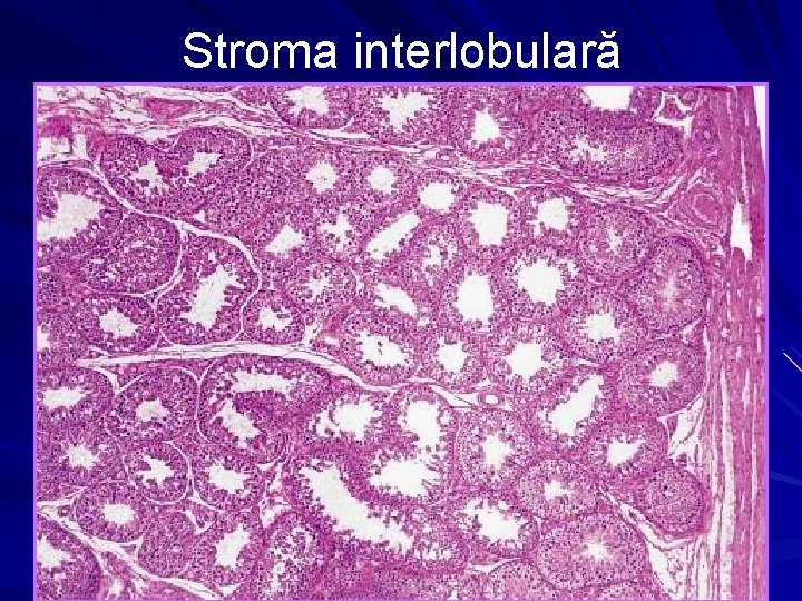 Stroma interlobulară 9 