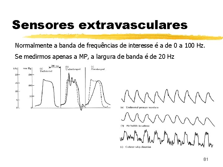 Sensores extravasculares Normalmente a banda de frequências de interesse é a de 0 a