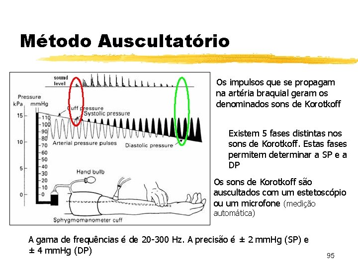 Método Auscultatório Os impulsos que se propagam na artéria braquial geram os denominados sons