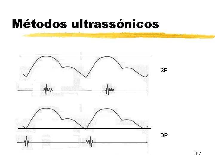 Métodos ultrassónicos SP DP 107 
