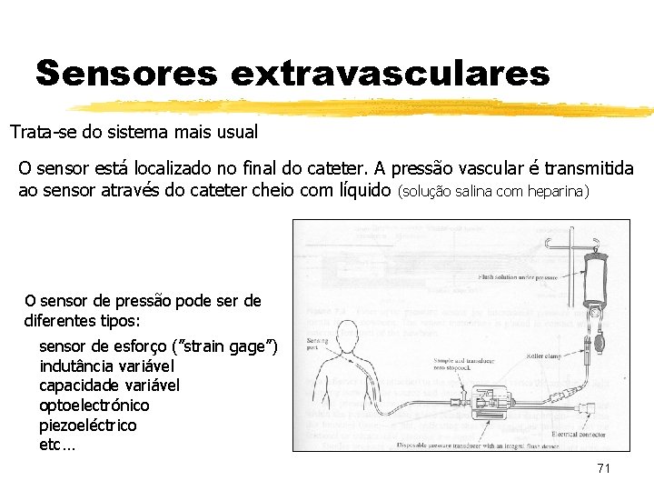 Sensores extravasculares Trata-se do sistema mais usual O sensor está localizado no final do Sensores extravasculares Trata-se do sistema mais usual O sensor está localizado no final do