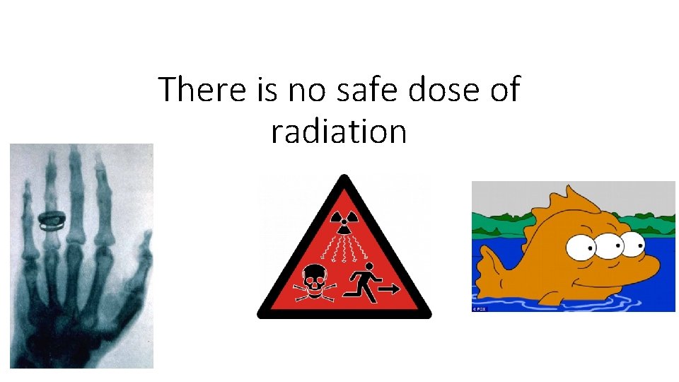 There is no safe dose of radiation 