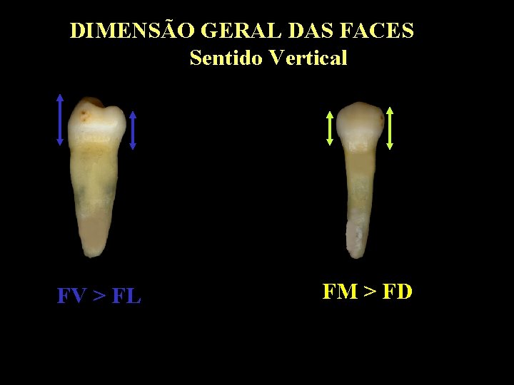 DIMENSÃO GERAL DAS FACES Sentido Vertical FV > FL FM > FD 
