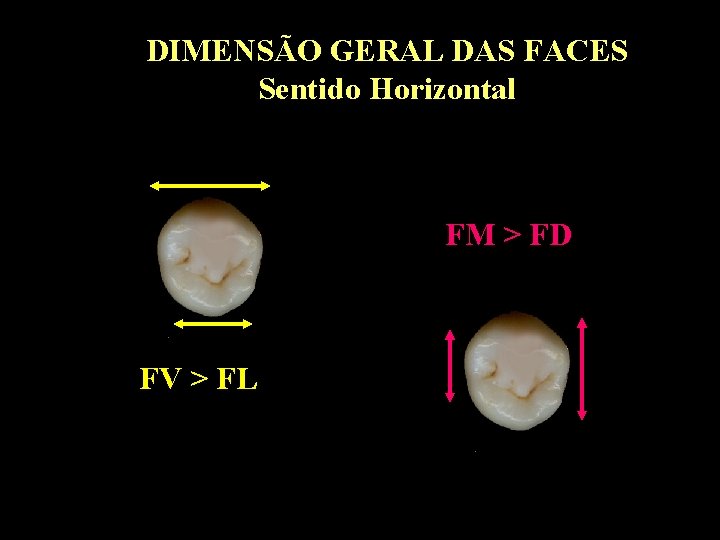 DIMENSÃO GERAL DAS FACES Sentido Horizontal FM > FD FV > FL 