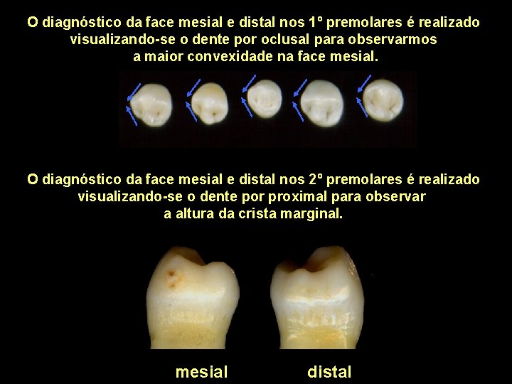O diagnóstico da face mesial e distal nos 1º premolares é realizado visualizando-se o